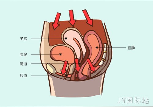 助力女性盆底功能健康发展，J9国际站推出高频评估电灼仪
